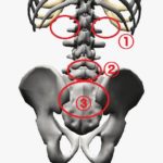 腰痛の出現部位
